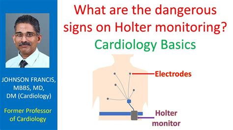 What Are The Dangerous Signs On Holter Monitoring Cardiology Basics