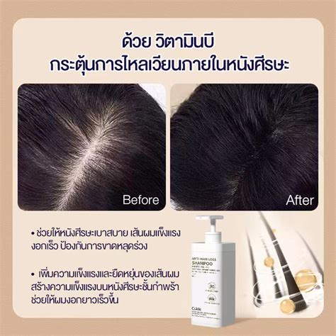 [ปริมาณ 900 มล ขนาดขายดี！] Cokki Anti Hair Loss Shampoo ยาสระผม ลดผมขาด