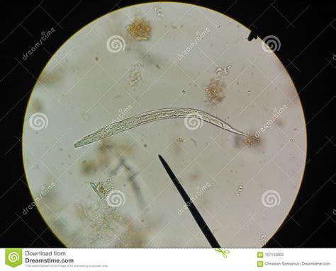 Close Up Egg with Adult of Parasite. Stock Image - Image of infection ...