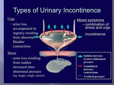 Pathophysiology Of Urinary Incontinence