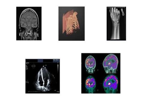 Medical Imaging Market Projected To Reach USD Billion By 2030 With 5