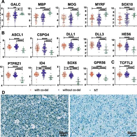 Suppressed Myelination Program In Pm Gliomas From The Cgga Dataset A