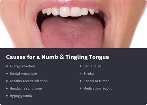 Reasons For Numb Or Tingling Tongue Symptoms And Treatment Byte® Byte®