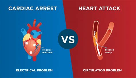 Differences Between Heart Attack And Cardiac Arrest Rapid Response