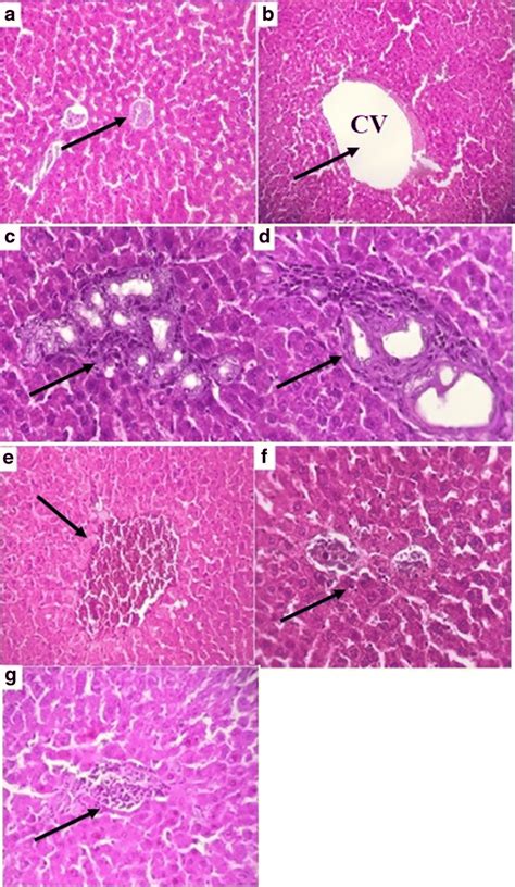 Photomicrographs Of Hematoxylin And Eosin Hande Stained Sections Of The