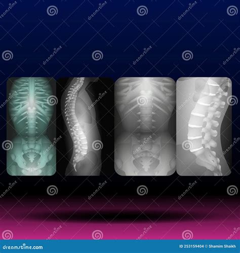 Espina Dorsal Xrays M Dula Espinal Anatom A Humana Ciencia De La Salud