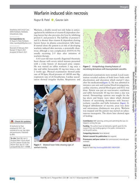 Pdf Warfarin Induced Skin Necrosis