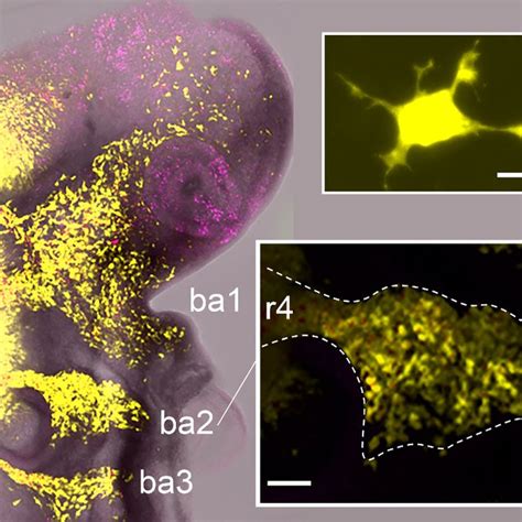 Neural Crest Cell Migratory Streams In The Chick Head Co Labelled With