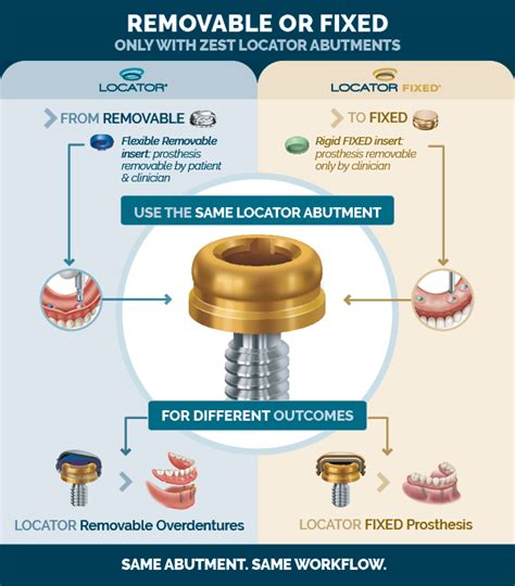 Locator Nobel Biocare Nobelactive Replace Conical Abutment Zest