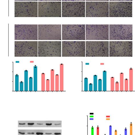 Xist Knockdown And Mir Mimics Suppress Os Cell Migration Invasion