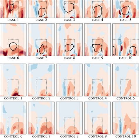 Oscillatory Shear Index Osi Under ‘normal Inflow Conditions The