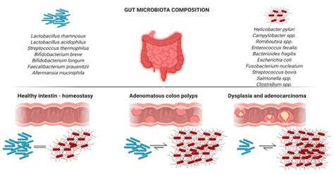 Types Of Bowel Polyps A Comprehensive Overview Ask The Nurse Expert