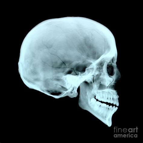 Adult Human Skull Photograph By D Roberts Science Photo Library Pixels