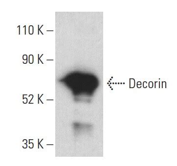 Anti Decorin Antibody C Scbt Santa Cruz Biotechnology