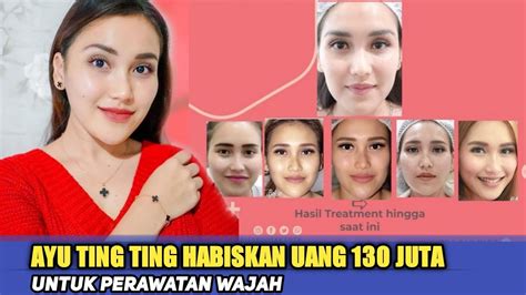 Ayu Ting Ting Habiskan Rp130 Juta Untuk Perawatan Wajah Satuin Aja