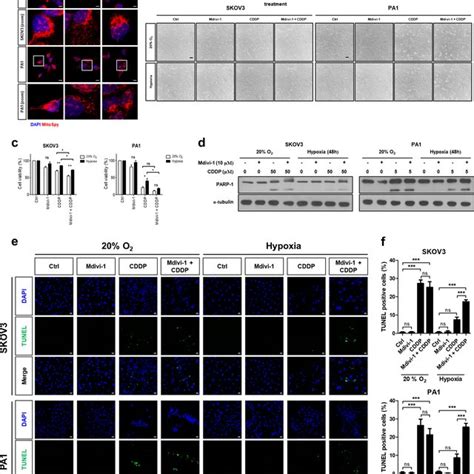 Hypoxia Promotes Mitochondrial Fission Through Drp Activation A To