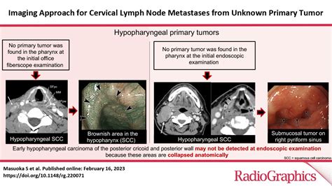 Imaging Approach For Cervical Lymph Node Metastases From Unknown