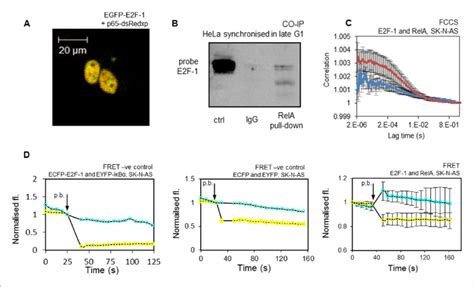 Interaction of E2F-1 with RelA. (A) Representative cell demonstrating ... 