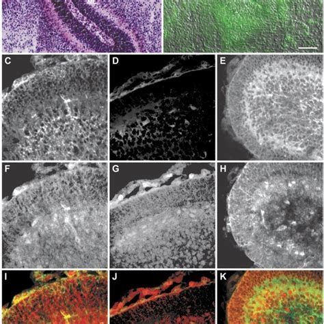 Double Immuno Fluorescence Analysis Of Cryostatic Sections Of Adult Rat