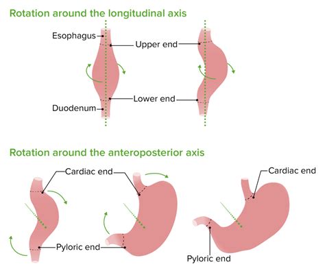 Development Of The Abdominal Organs Concise Medical Knowledge