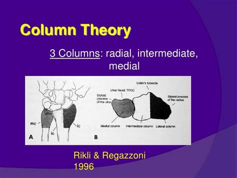 Dr Yt Reddy Distal Radius Fractures Modified