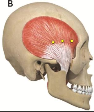 Mandibular Movement Flashcards Quizlet