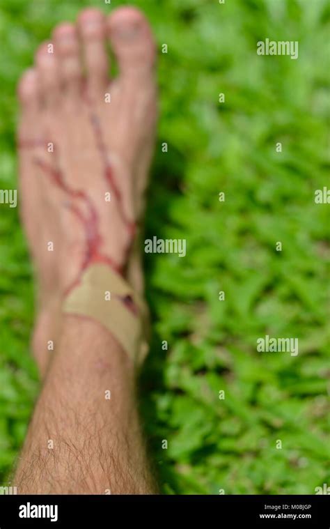 Injured Male Foot With Real Blood On A Green Grass Background