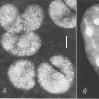 Nuclei in internodal cells of members of the genus Chara. Bars: Figs.... | Download Scientific ...