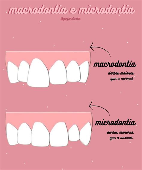 Macrodontia E Microdontia