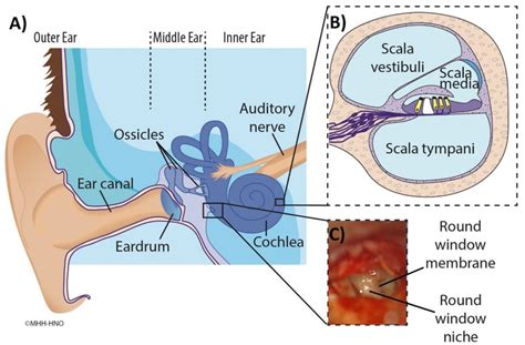 Ear Model Labeled Round Window