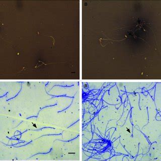 Representative Images Of Sperm Viability And Morphology A Control