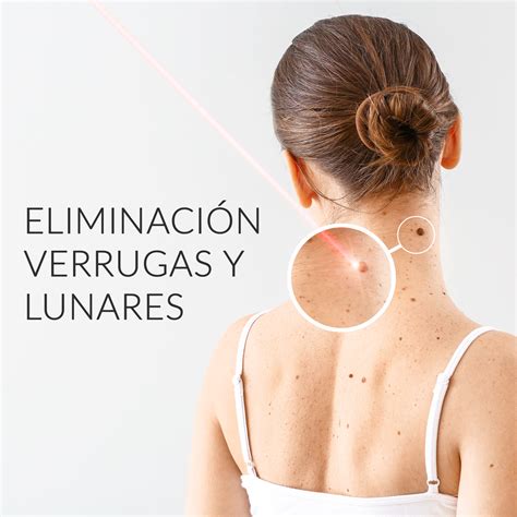 Clinica Medicina Estetica Corporal En Vigo Eliminacion Verrugas Y