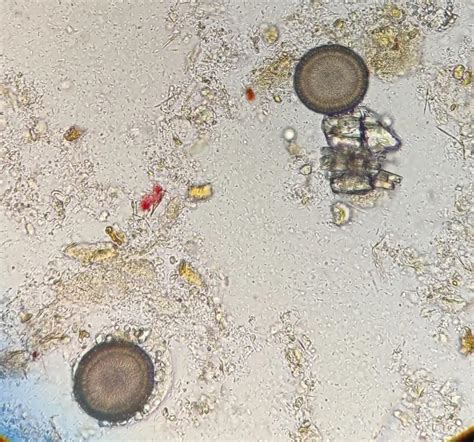 MICROBIO On Twitter Huevos De Taenia Spp Los Huevos De Taenia