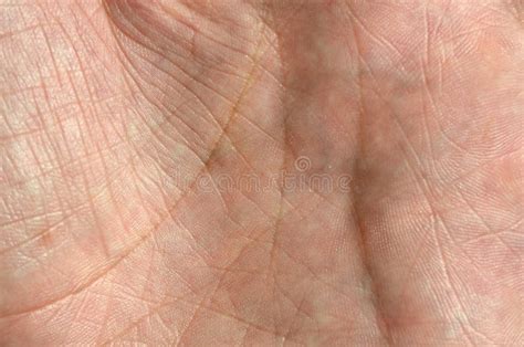 Close Up Of Human Hand Skin With Visible Skin Texture And Lines Stock