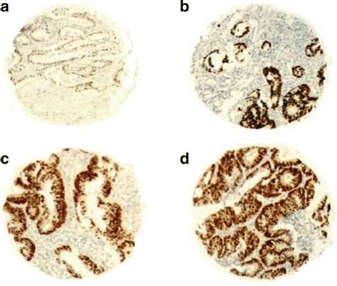 Immunohistochemical Staining Of Cdx Protein A Non Stained Samples As