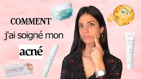 COMMENT J AI SOIGNÉ MON ACNÉ Pilule traitement causes JE VOUS