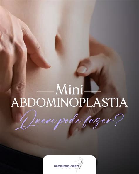 Conhe A A Miniabdominoplastia Dr Vinicius Zolezi