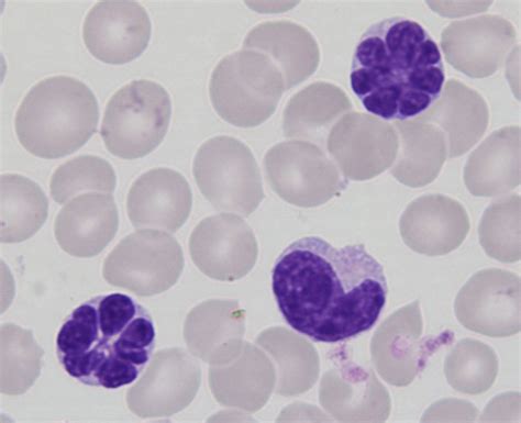 Human T Cell Leukemia Virus Type I Htlv I Infection And The Onset Of