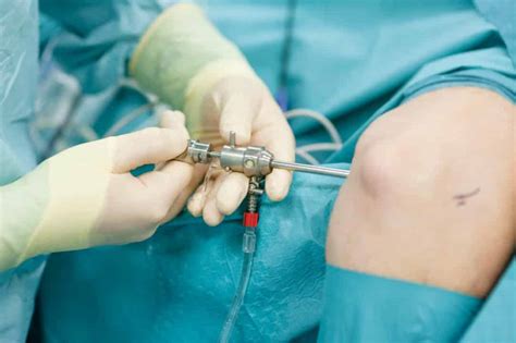 Chirurgie orthopédique du membre supérieur à Paris Main épaule