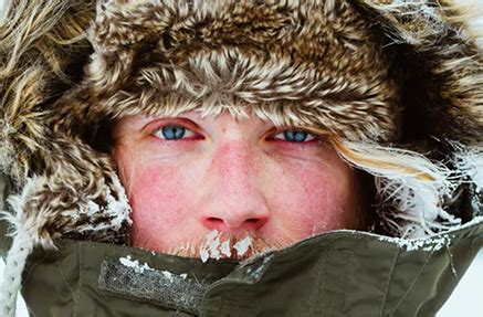 How To Prevent And Treat Windburn, Winter's Overlooked Skin Condition | Dermatology | GW School ...