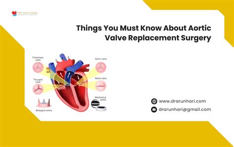 Aortic Valve Surgery: Repair vs Replacement, Risks, and Recovery