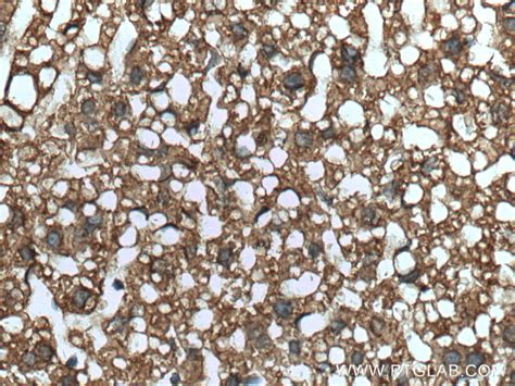 SLC25A6 antibody 51031 1 AP Proteintech 武汉三鹰生物技术有限公司