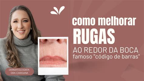 Melhores Tratamentos Para Rugas Ao Redor Da Boca Dermato Dra Carolina