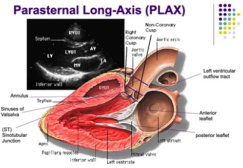 Chapter 2 Transthoracic Views Normal Anatomy And Flow Patterns