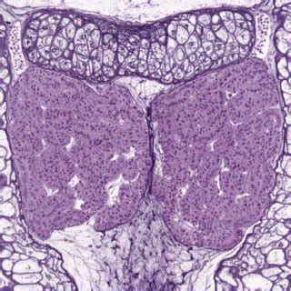 High 40x Magnification Photomicrograph Of Thyroid Gland From X