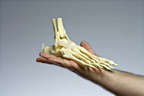 The Sesamoid Bone - Consulting Footpain