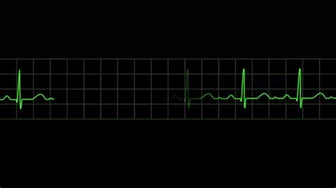 Ekg clipart gif transparent, Ekg gif transparent Transparent FREE for ...