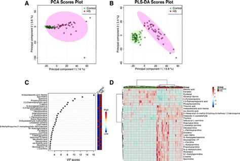 Metabolic Profile In DBS Of HS Patients A PCA Plot And B PLS DA