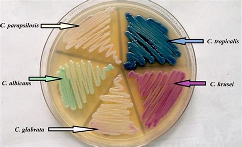 Candida glabrata- An Overview