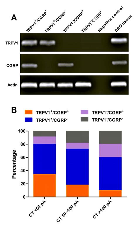 Single Cell Reverse Transcriptase Pcr Analysis For Trpv1 And Cgrp Mrna